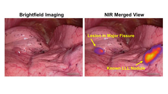 Brightfield Imaging