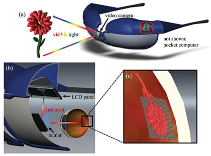 photo pf PV retinal prosthesis 