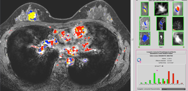 From Research To Commercialization Ai Diagnostic Tool Aims - 