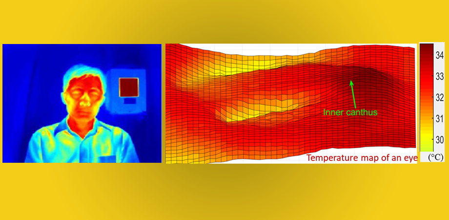 Cool Eyes on Fever Screening: Optimizing Infrared Thermography