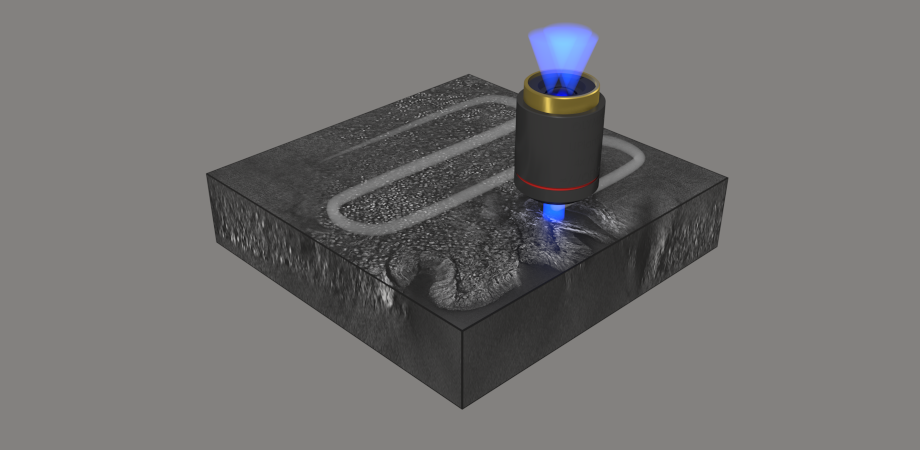 Schematic of the imaging of pathological tissue 3D structure