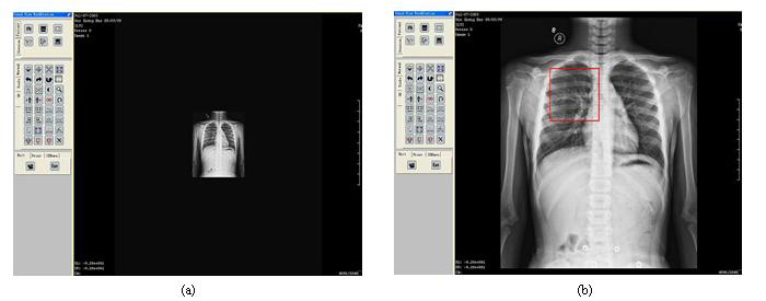 Accessing Medical Image Databases On The Go - 