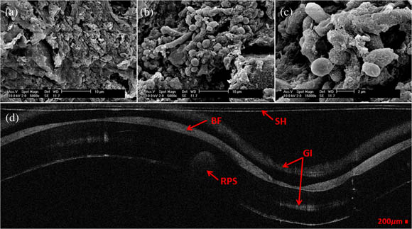 Images of biofilm in endotracheal tubation