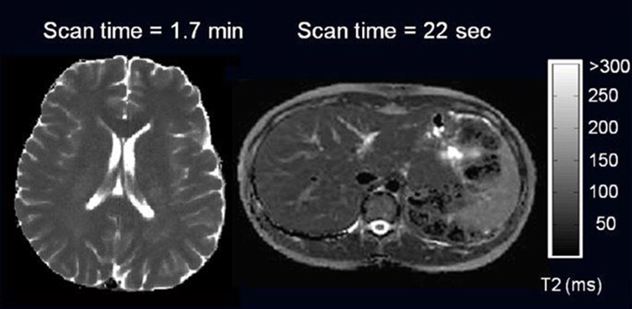 Spin-spin relaxation time (T2) maps of brain and liver