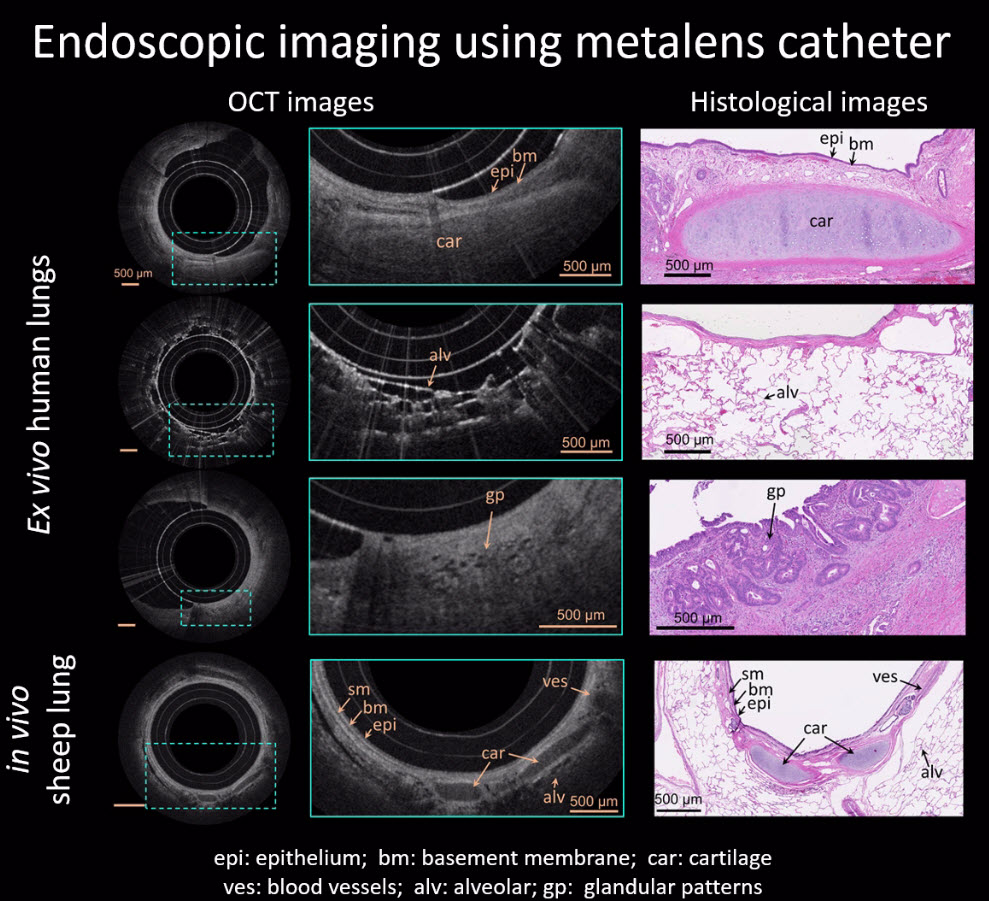 Federico Capasso: edoscopic imaging using metalens catheter