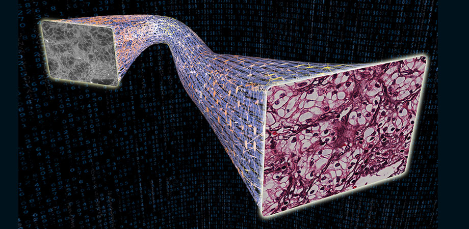 Deep neural nets virtually stiain tissue samples