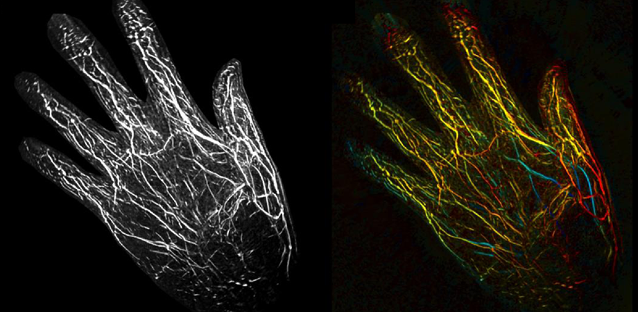 Imaging extremities
