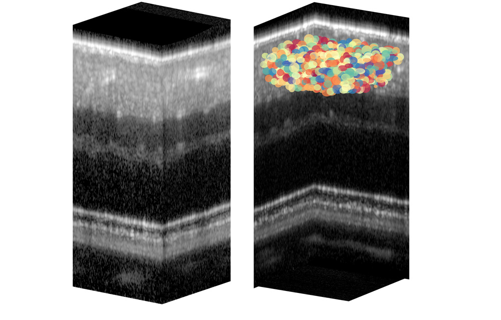 ganglion cells identified with AI