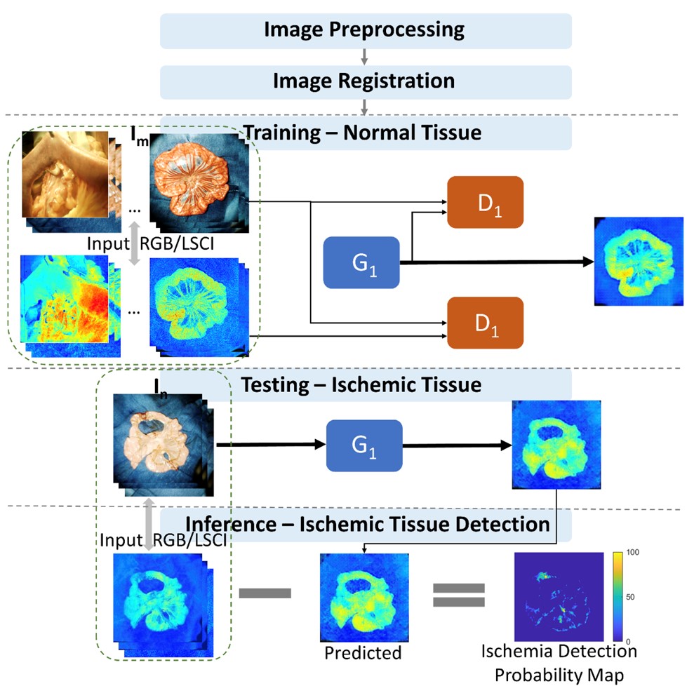Proposed workflow for objective detection of ischemic bowel tissue 