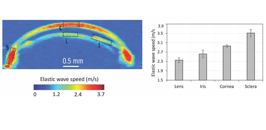 https://spie.org/images/Graphics/Newsroom/2023articles/Eye%20elasticity%20-%20920.jpg