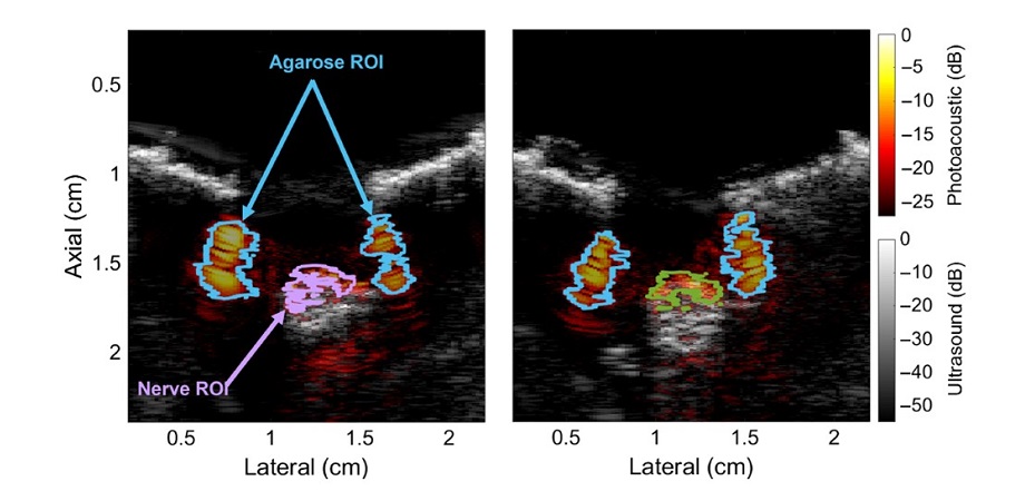 Medical optical imaging using the world's first 'ultrasound