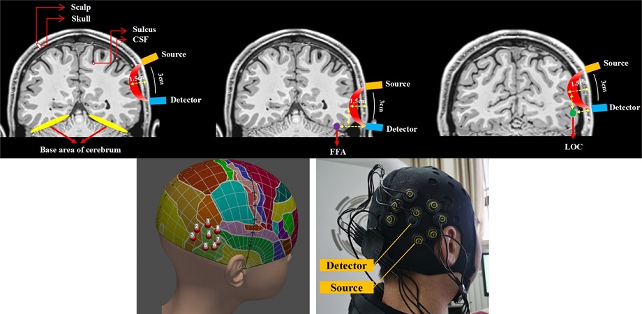 Functional near-infrared spectroscopy (fNIRS) can be performed using a portable emitter and detector placed on the scalp 