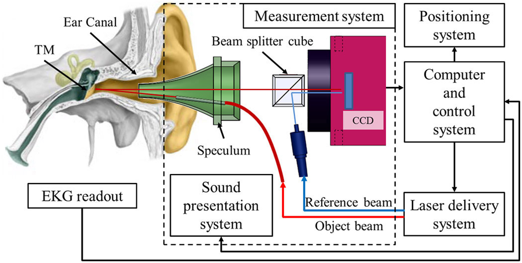 Assessing eardrum deformation by digital holography