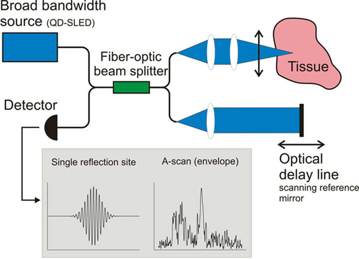 Quantum-dot diodes provide sources for optical coherence tomography