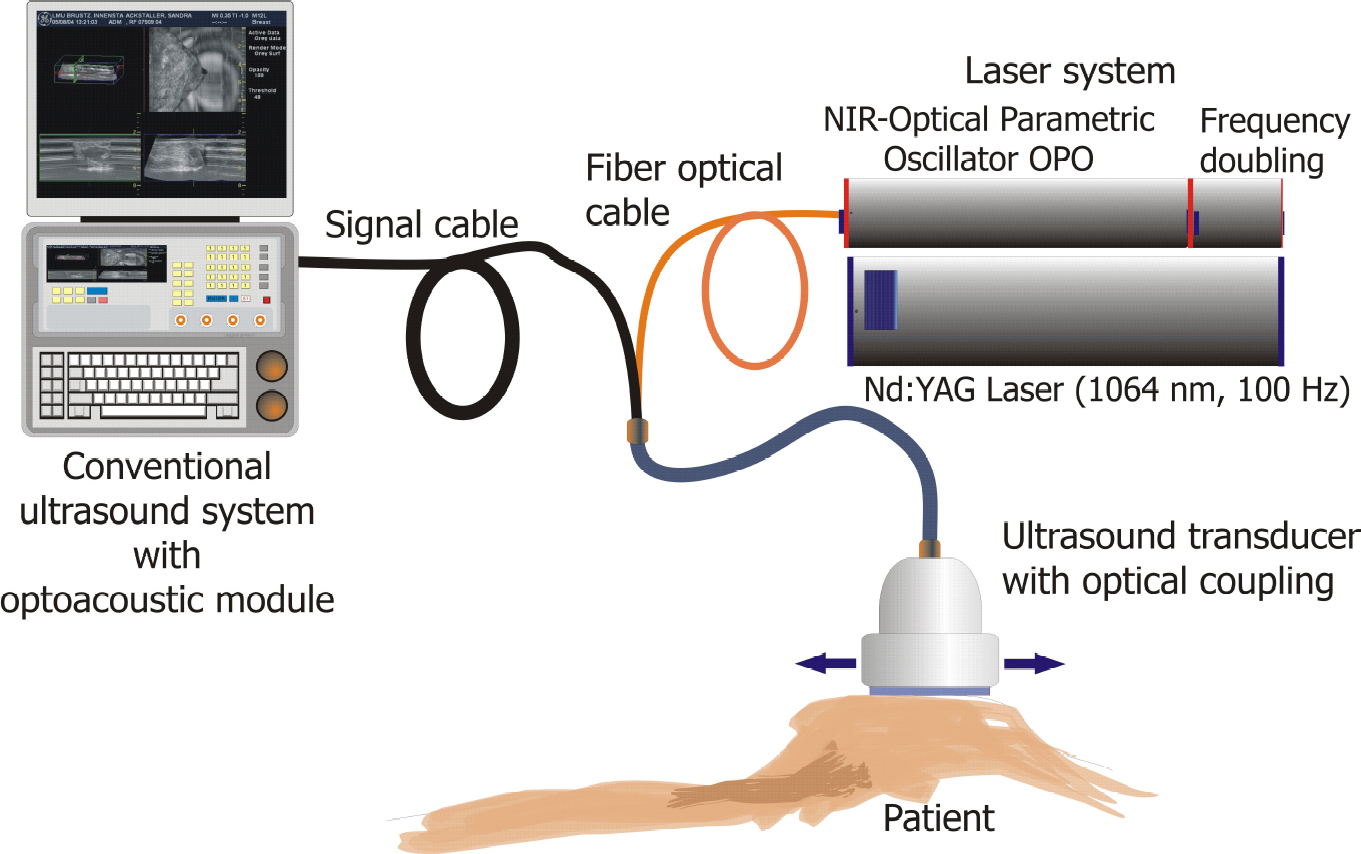 optoacoustics-plus-ultrasound-may-improve-breast-cancer-detection